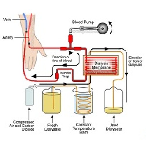 Haemodialysis dry powder